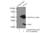 PCNA Antibody in Immunoprecipitation (IP)