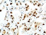 PCNA Antibody in Immunohistochemistry (Paraffin) (IHC (P))