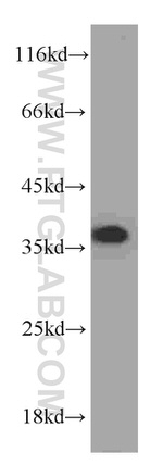 PCNA Antibody in Western Blot (WB)