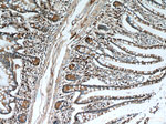 Human IgA Antibody in Immunohistochemistry (Paraffin) (IHC (P))