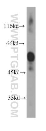 Human IgA Antibody in Western Blot (WB)