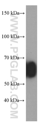 Human IgA Antibody in Western Blot (WB)