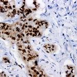 Phospho-LRP6 (Thr1479) Antibody in Immunohistochemistry (Paraffin) (IHC (P))