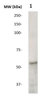 H1N1 (Influenza A virus) Antibody in Western Blot (WB)