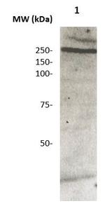 Coagulation Factor VIII (Fused form) Antibody in Western Blot (WB)