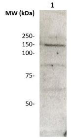 Coagulation Factor VIII (Cleaved form, N-term) Antibody in Western Blot (WB)