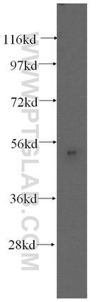 Fibromodulin Antibody in Western Blot (WB)