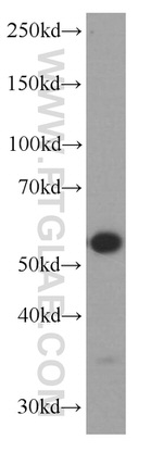 ST2 Antibody in Western Blot (WB)
