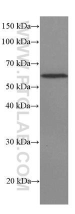 ST2 Antibody in Western Blot (WB)