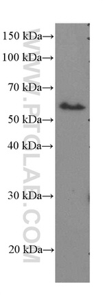 ST2 Antibody in Western Blot (WB)