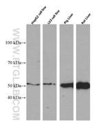 SERPINA10 Antibody in Western Blot (WB)