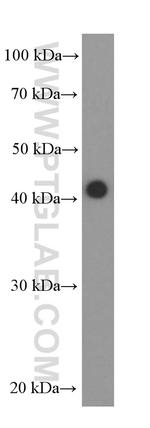 NR2F6 Antibody in Western Blot (WB)