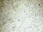 NR2F6 Antibody in Immunohistochemistry (Paraffin) (IHC (P))