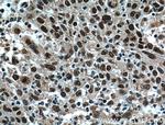 BRD8 Antibody in Immunohistochemistry (Paraffin) (IHC (P))