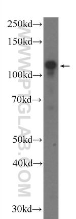 BRD8 Antibody in Western Blot (WB)