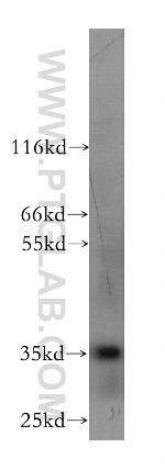 CXCL16 Antibody in Western Blot (WB)