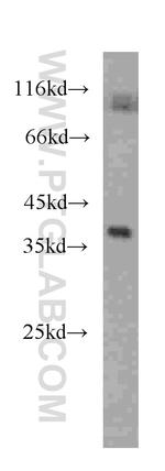 RENALASE Antibody in Western Blot (WB)