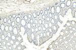 Chromogranin A Antibody in Immunohistochemistry (Paraffin) (IHC (P))