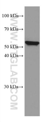 IL-15RA Antibody in Western Blot (WB)