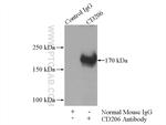 CD206 Antibody in Immunoprecipitation (IP)