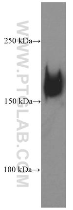 CD206 Antibody in Western Blot (WB)