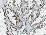 PAX8 Antibody in Immunohistochemistry (Paraffin) (IHC (P))