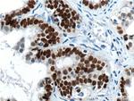 PAX8 Antibody in Immunohistochemistry (Paraffin) (IHC (P))