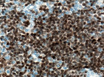 PAX8 Antibody in Immunohistochemistry (Paraffin) (IHC (P))