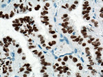 PAX8 Antibody in Immunohistochemistry (Paraffin) (IHC (P))