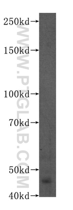 PAX8 Antibody in Western Blot (WB)