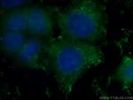 GSTO1 Antibody in Immunocytochemistry (ICC/IF)