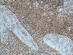 GSTO1 Antibody in Immunohistochemistry (Paraffin) (IHC (P))