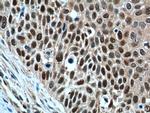 GSTO1 Antibody in Immunohistochemistry (Paraffin) (IHC (P))