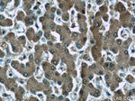 GSTO1 Antibody in Immunohistochemistry (Paraffin) (IHC (P))