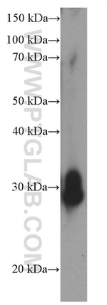 GSTO1 Antibody in Western Blot (WB)