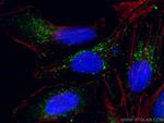 ABCD1 Antibody in Immunocytochemistry (ICC/IF)