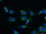 ABCD1 Antibody in Immunocytochemistry (ICC/IF)