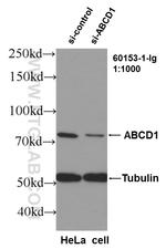 ABCD1 Antibody in Western Blot (WB)