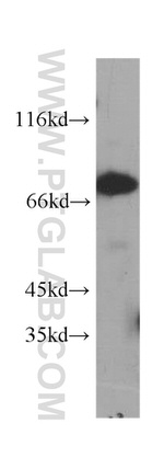 ABCD1 Antibody in Western Blot (WB)