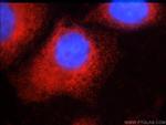 SMN Antibody in Immunocytochemistry (ICC/IF)