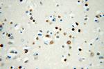 SMN Antibody in Immunohistochemistry (Paraffin) (IHC (P))