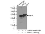 SMN Antibody in Immunoprecipitation (IP)