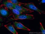 SMN Antibody in Immunocytochemistry (ICC/IF)