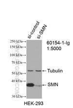 SMN Antibody in Western Blot (WB)