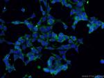 SMN Antibody in Immunocytochemistry (ICC/IF)