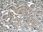 EPHA1 Antibody in Immunohistochemistry (Paraffin) (IHC (P))