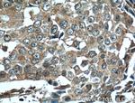 EPHA1 Antibody in Immunohistochemistry (Paraffin) (IHC (P))