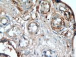 AMOT Antibody in Immunohistochemistry (Paraffin) (IHC (P))