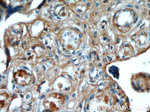 AMOT Antibody in Immunohistochemistry (Paraffin) (IHC (P))