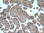 AMOT Antibody in Immunohistochemistry (Paraffin) (IHC (P))